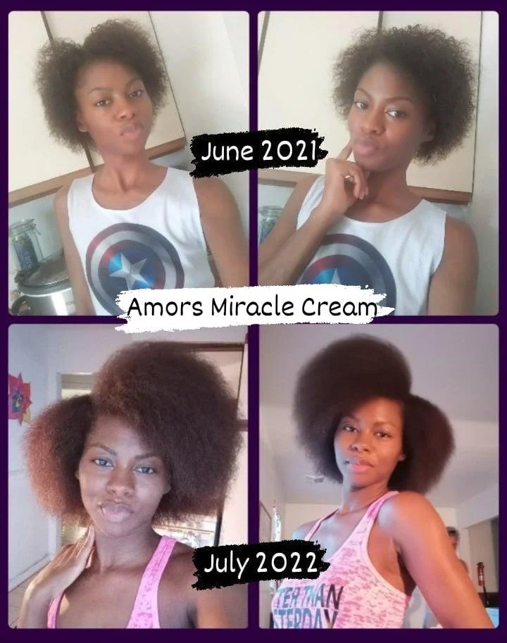 Results of using only Amor's Miracle Cream