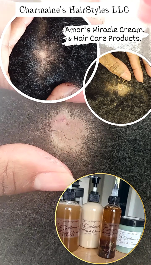 Treated Infection using Amor's Miracle Growth Oil and Cream