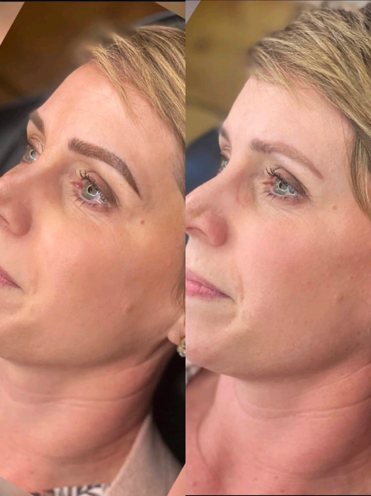 cameraRollTempImage (2).JPG