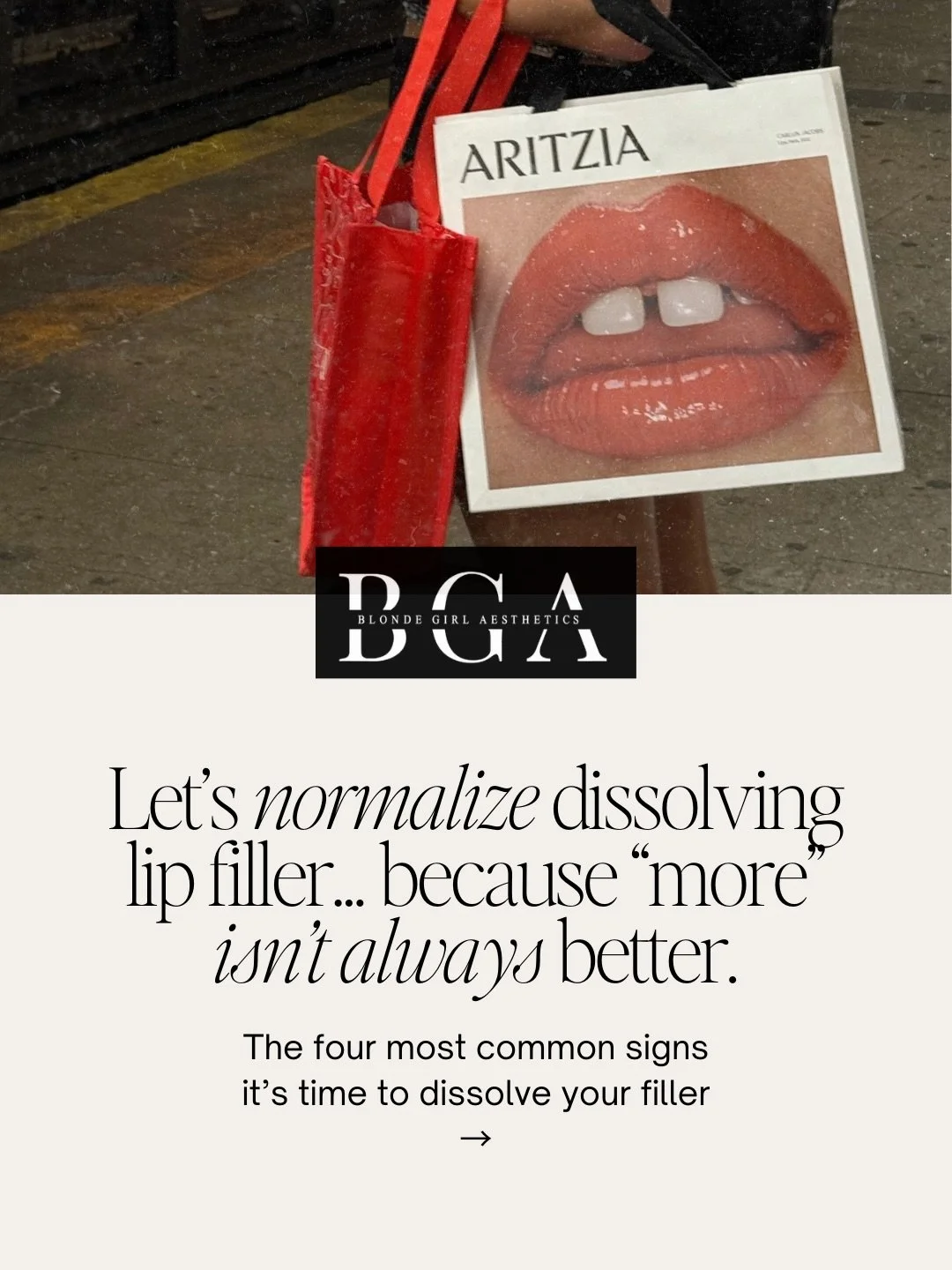𝐍𝐨𝐭 𝐚𝐥𝐥 𝐥𝐢𝐩 𝐟𝐢𝐥𝐥𝐞𝐫 𝐬𝐡𝐨𝐮𝐥𝐝 𝐬𝐭𝐚𝐲.✨Let&rsquo;s normalize dissolving lip filler.

At BGA, we don&rsquo;t chase volume &mdash; 𝐰𝐞 𝐟𝐨𝐜𝐮𝐬 𝐨𝐧 𝐛𝐚𝐥𝐚𝐧𝐜𝐞, 𝐬𝐭𝐫𝐮𝐜𝐭𝐮𝐫𝐞, 𝐚𝐧𝐝 𝐥𝐨𝐧𝐠-𝐭𝐞𝐫𝐦 𝐡𝐚𝐫𝐦𝐨𝐧𝐲.

Over
