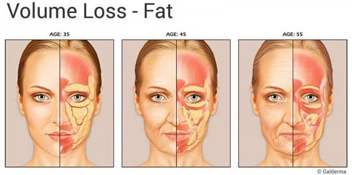 Why should I get a facial fat transfer?