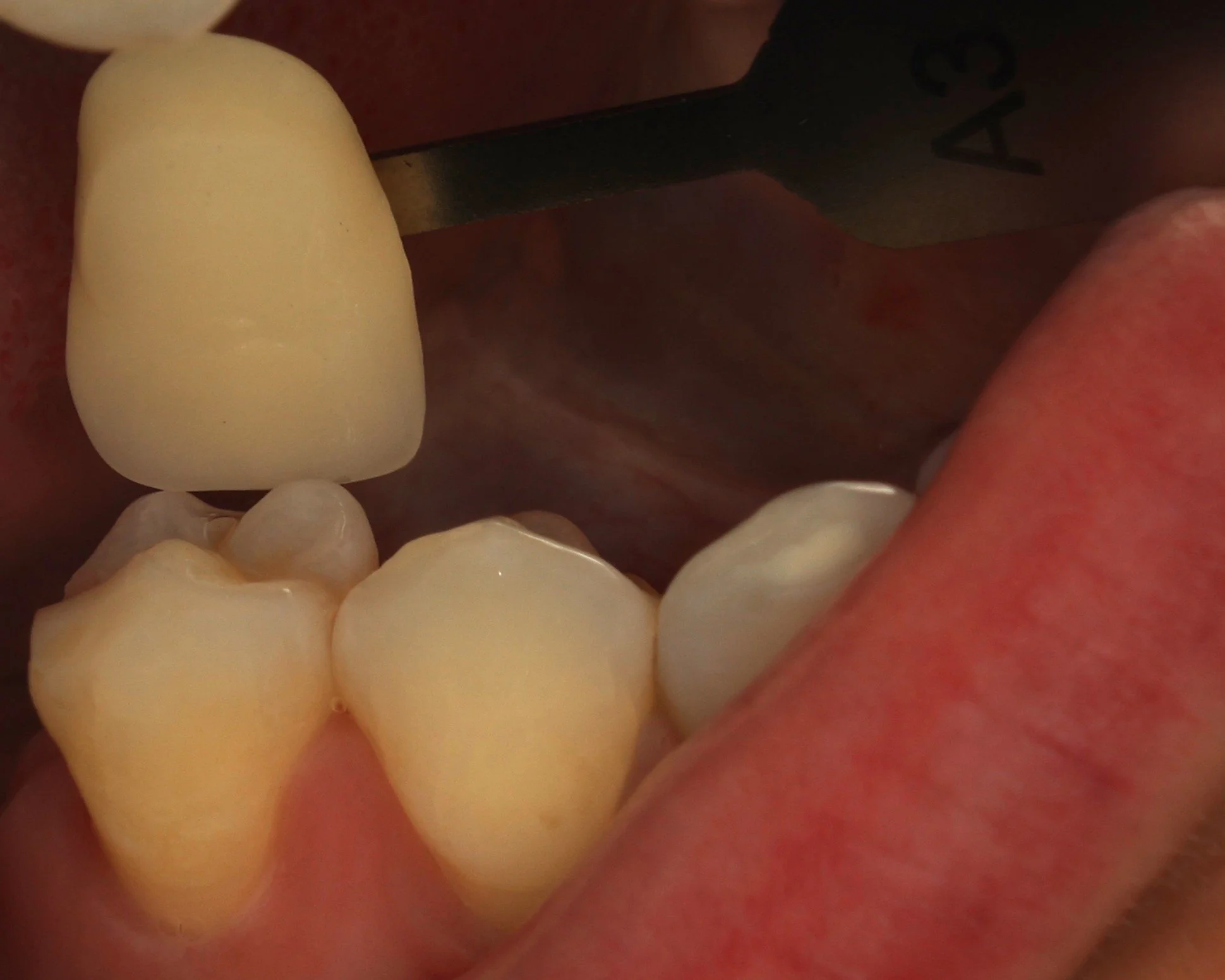 2 - Prise de teinte polarisée.JPG