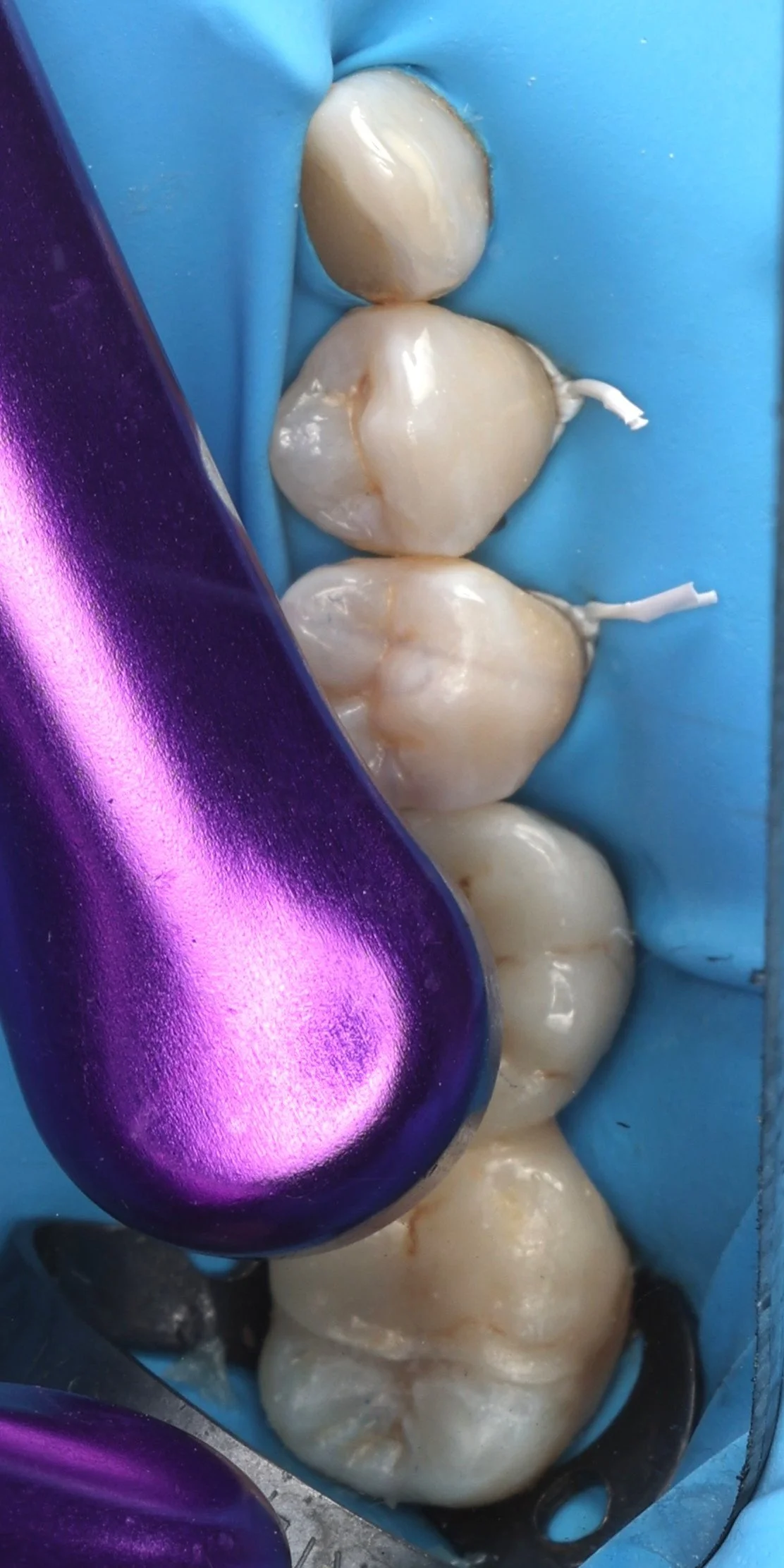 12 - Collage composite chauffé 3.JPG