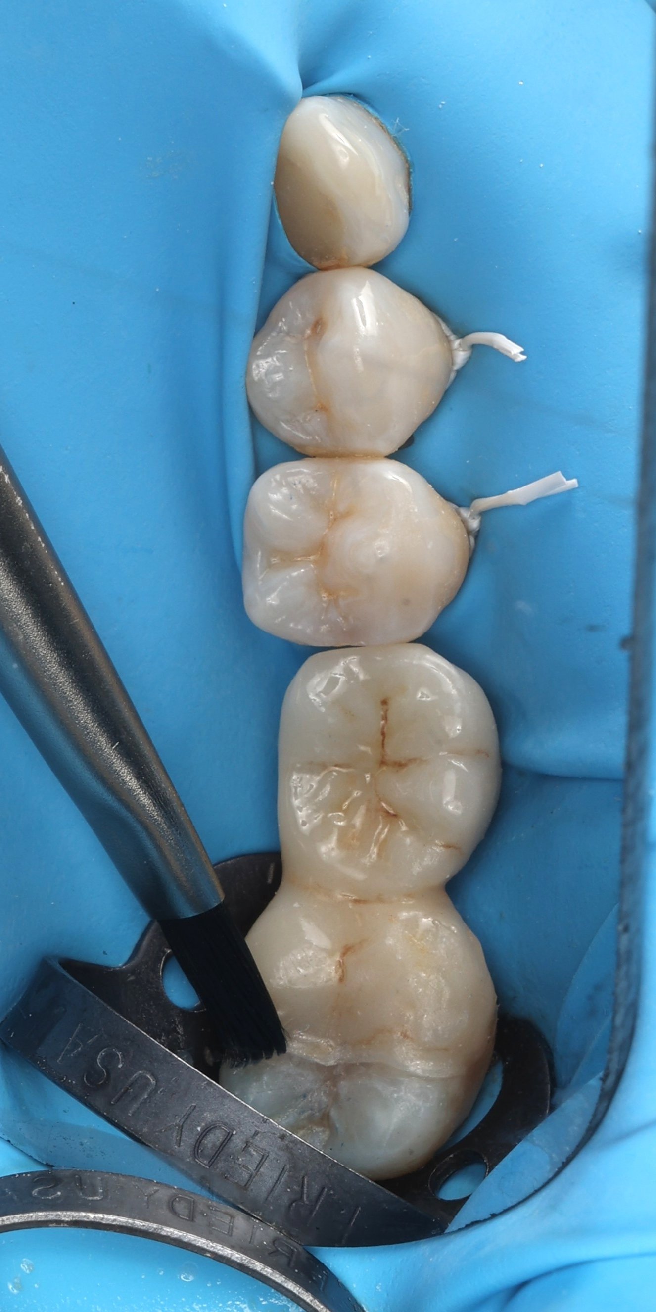 12 - Collage composite chauffé 2.JPG