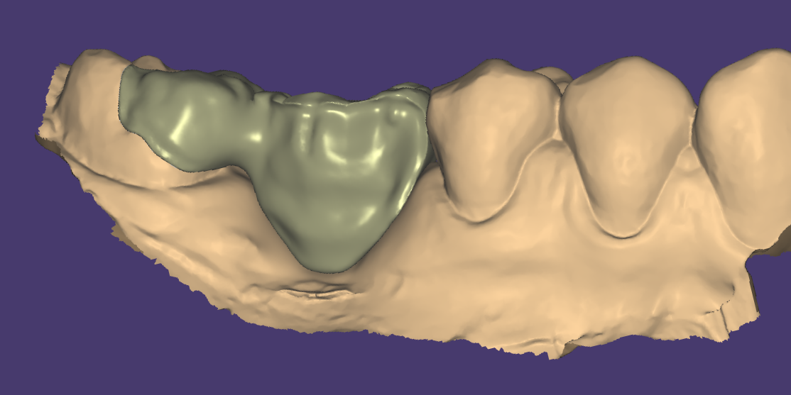 5 - Design Labo 2.png