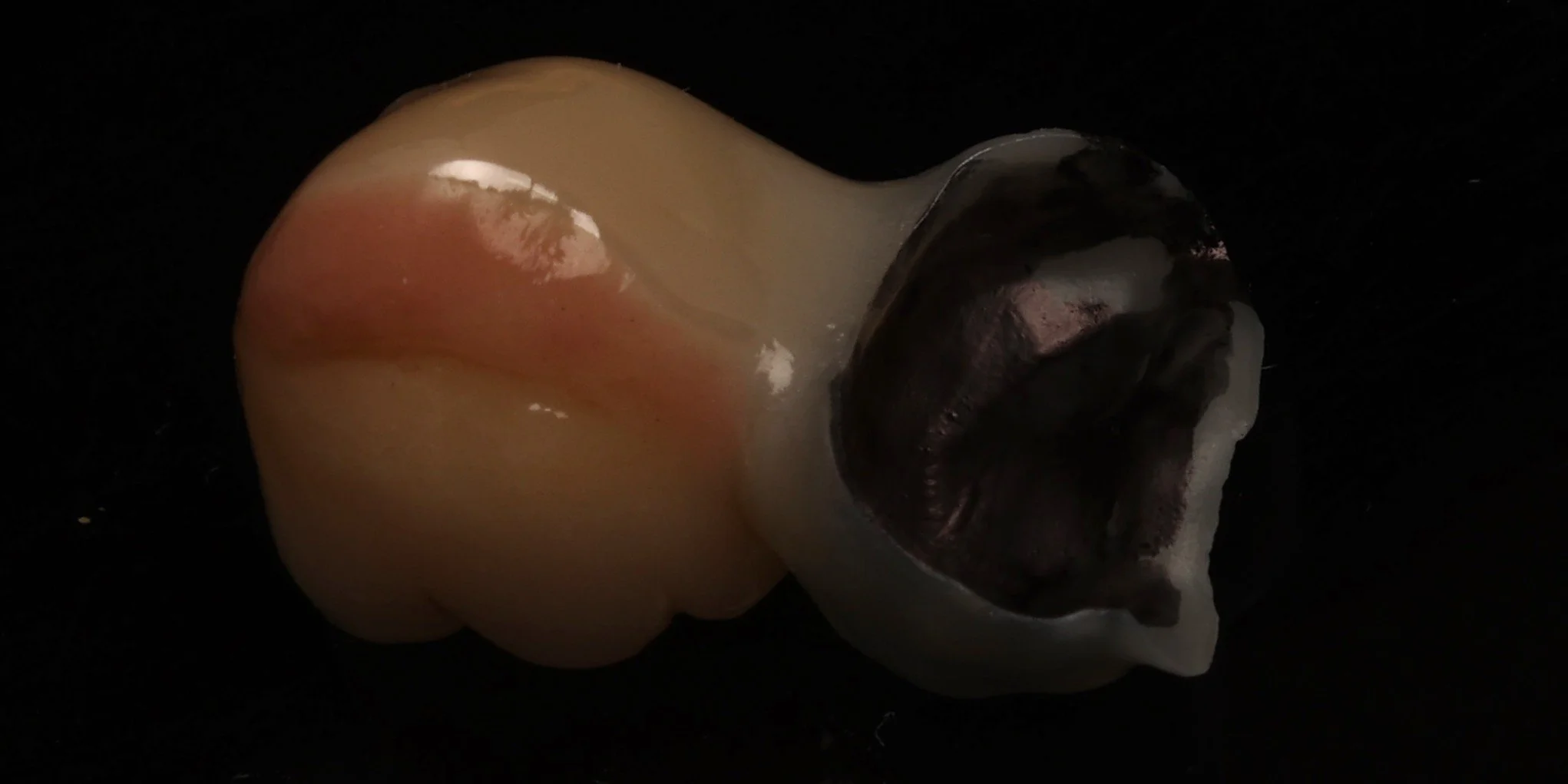 8 - Avant Sablage BCCP.JPG