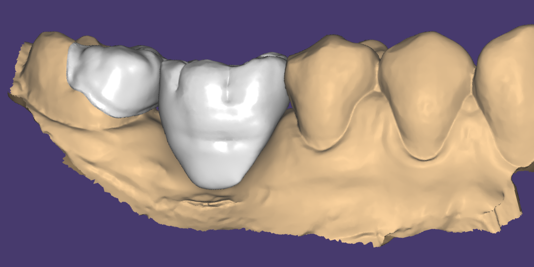 5 - Design Labo 1.png