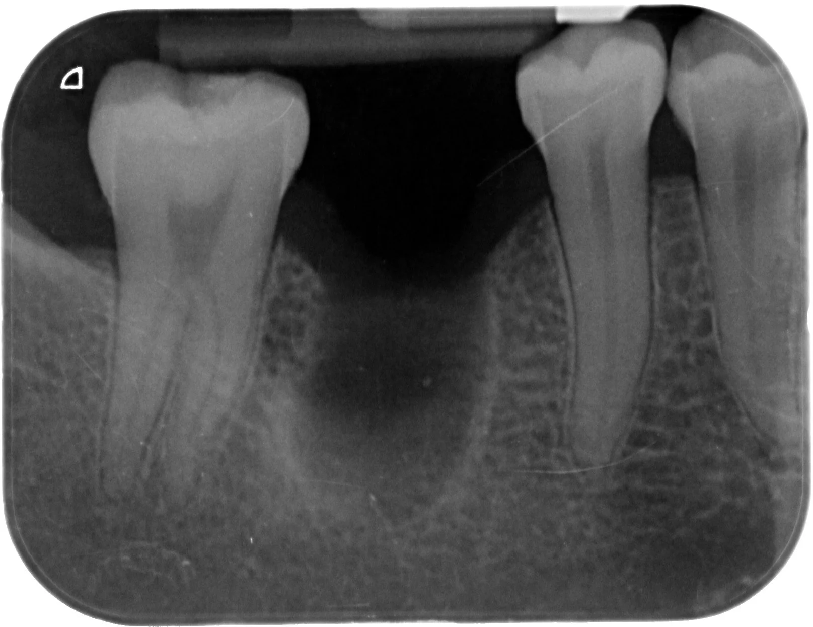 1 - Situation initiale radio.JPG