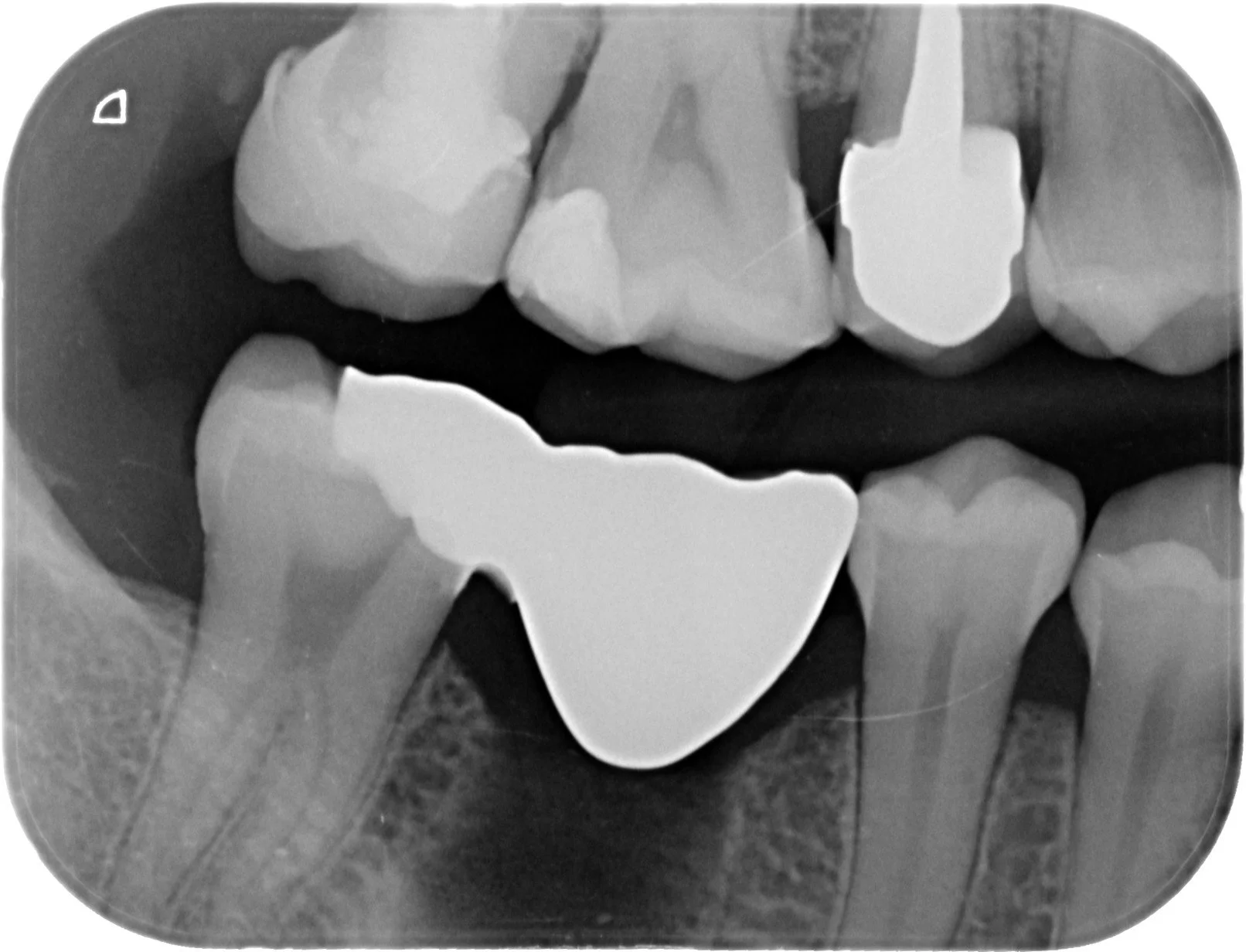 16 - RX contrôle final.JPG