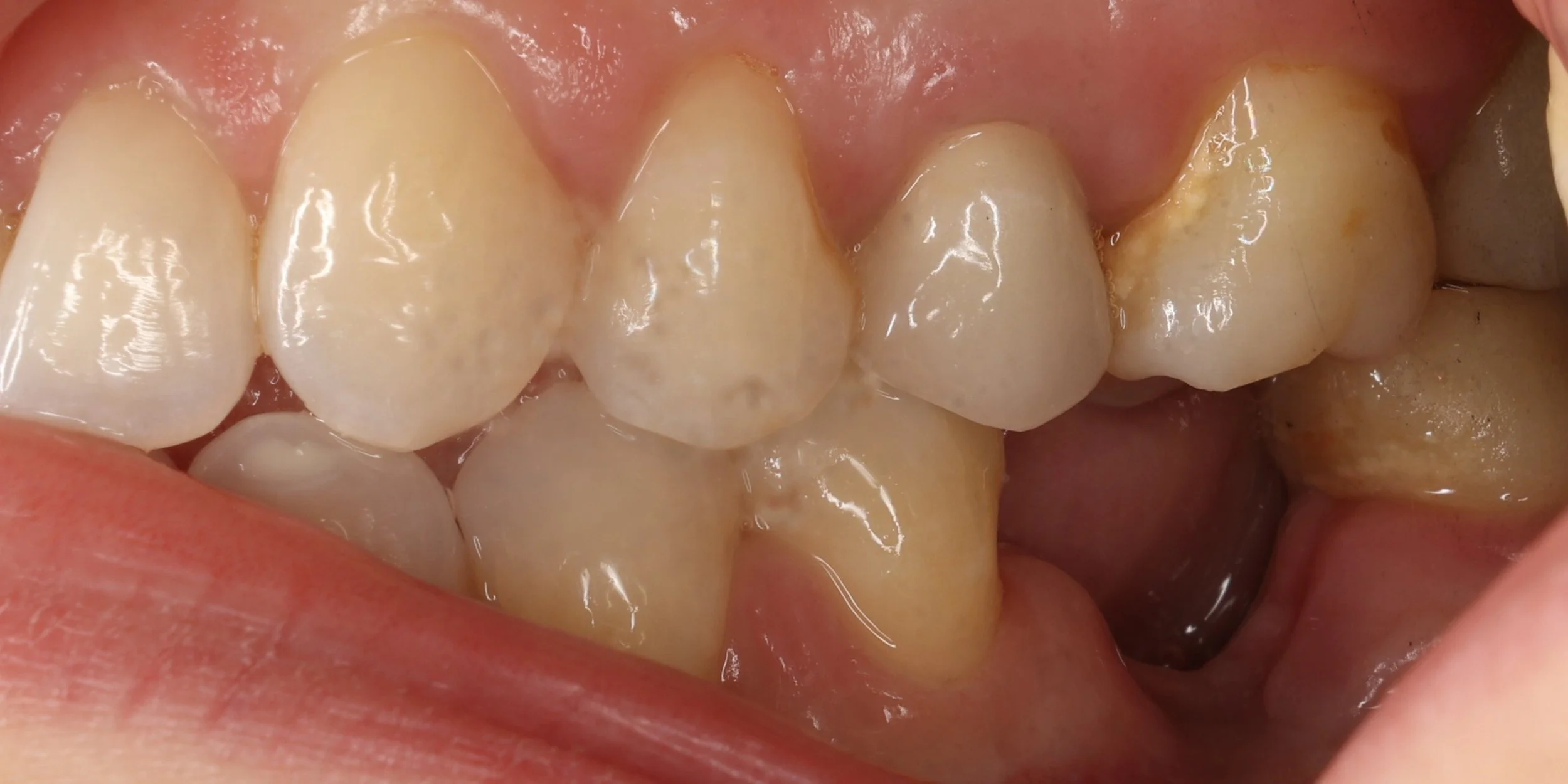 1 - Situation initiale V.JPG