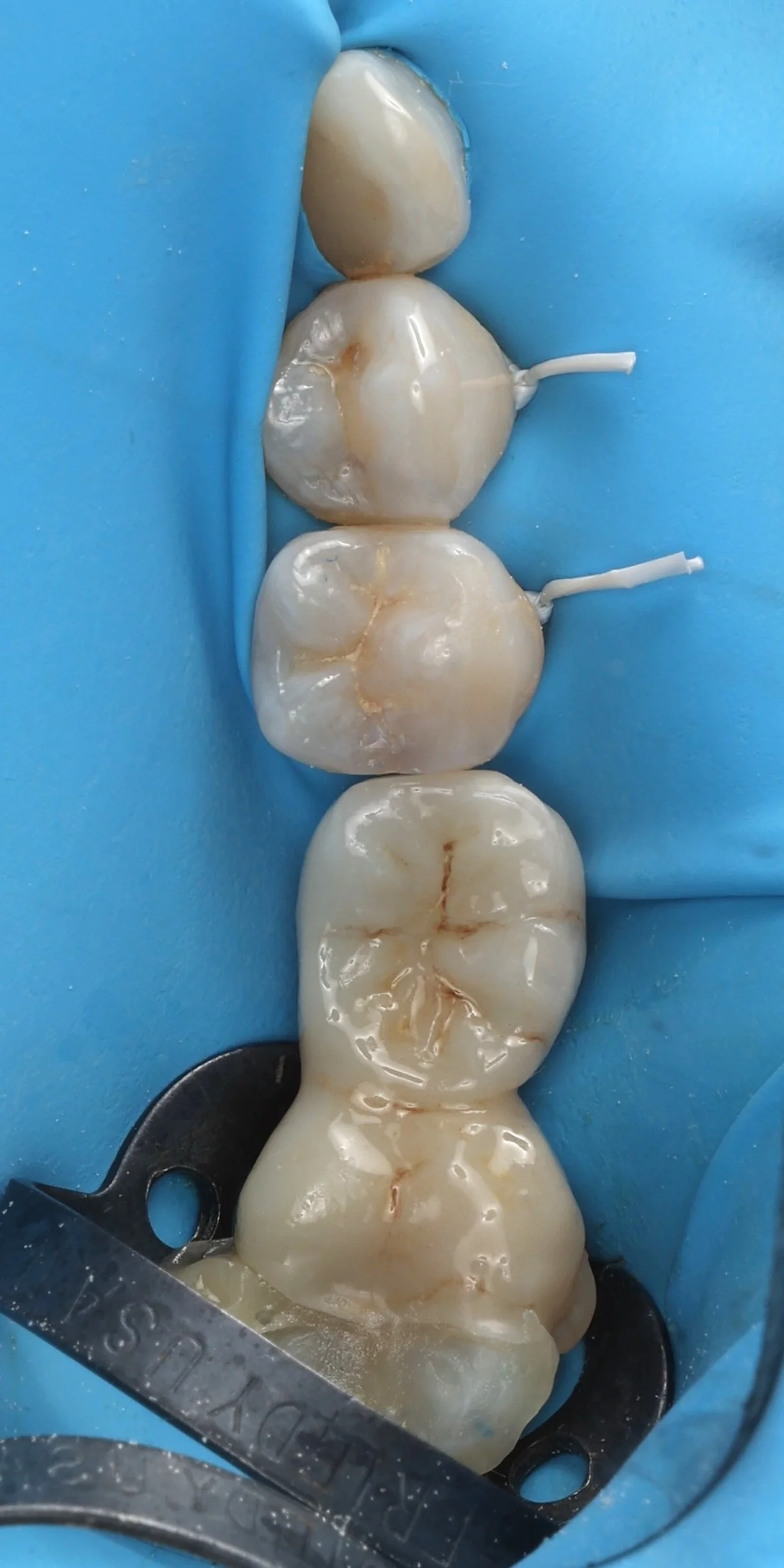 12 - Collage composite chauffé 1.JPG