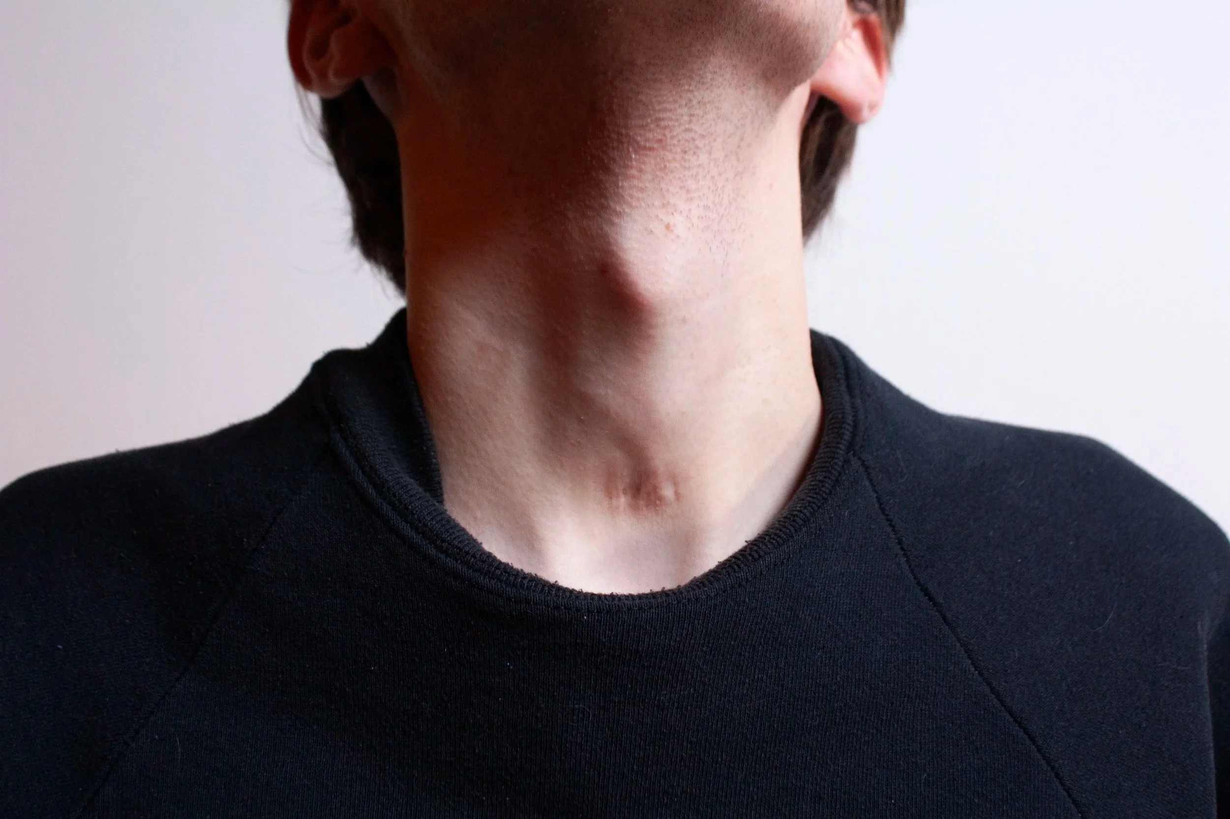 The Body Keeps the Score