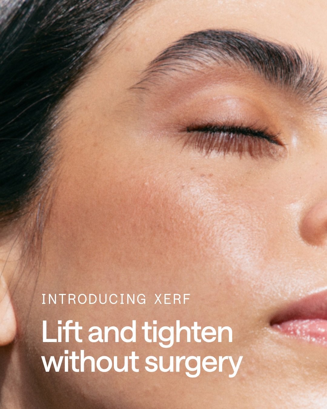 It&rsquo;s here! Introducing XERF at &Eacute;LAN by AYA Skin, an FDA-cleared, non-invasive treatment that tightens and lifts by remodeling the deeper structural layers of your skin. 

No needles, no incisions, no downtime.
 
 
WHAT MAKES XERF DIFFERE