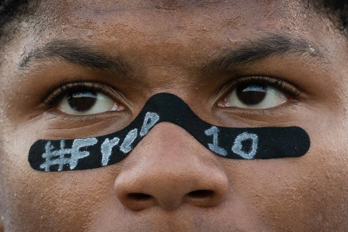 Lewisville linebacker Donavin Burel wears nose tape saying “#Free10” during a football game between Lewisville and Marcus at Max Goldsmith Stadium on Friday, September 25, 2026 in Lewisville, Texas.
