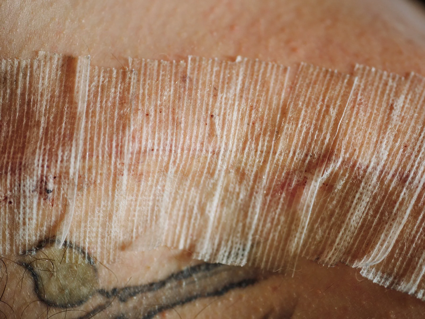 2025-12-18 - Zach Cutburth Collarbone - 0091_web.jpg