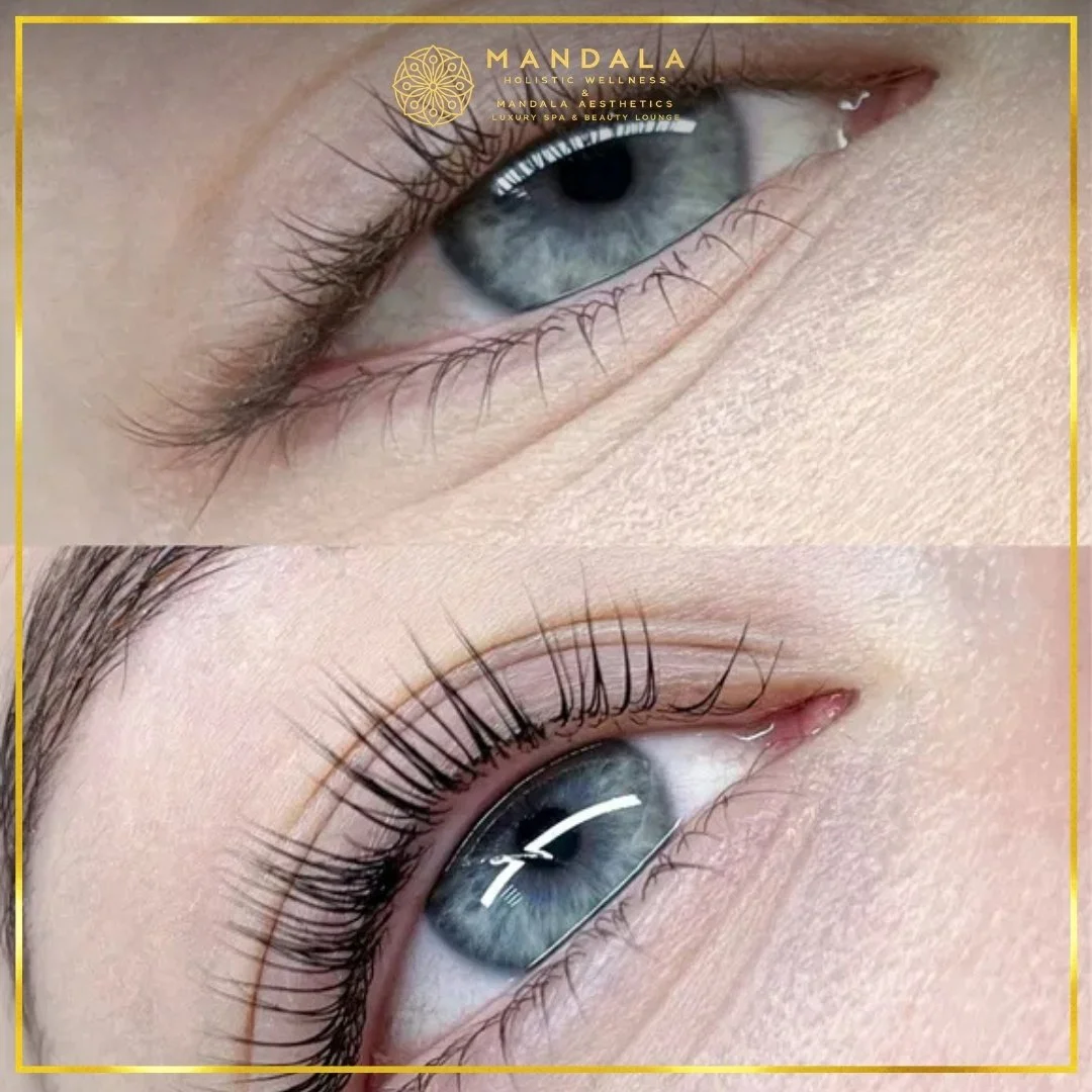 K-Lash Lift and Botox before and after results showing naturally lifted and defined lashes at Mandala Aesthetics in Preston, Melbourne.
