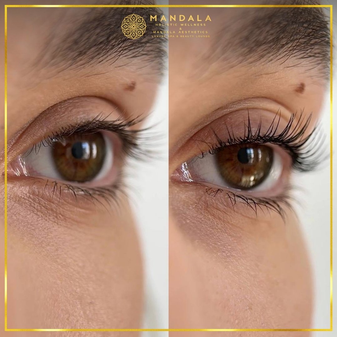 K-Lash Lift and Botox before and after results showing naturally lifted and defined lashes at Mandala Aesthetics in Preston, Melbourne.