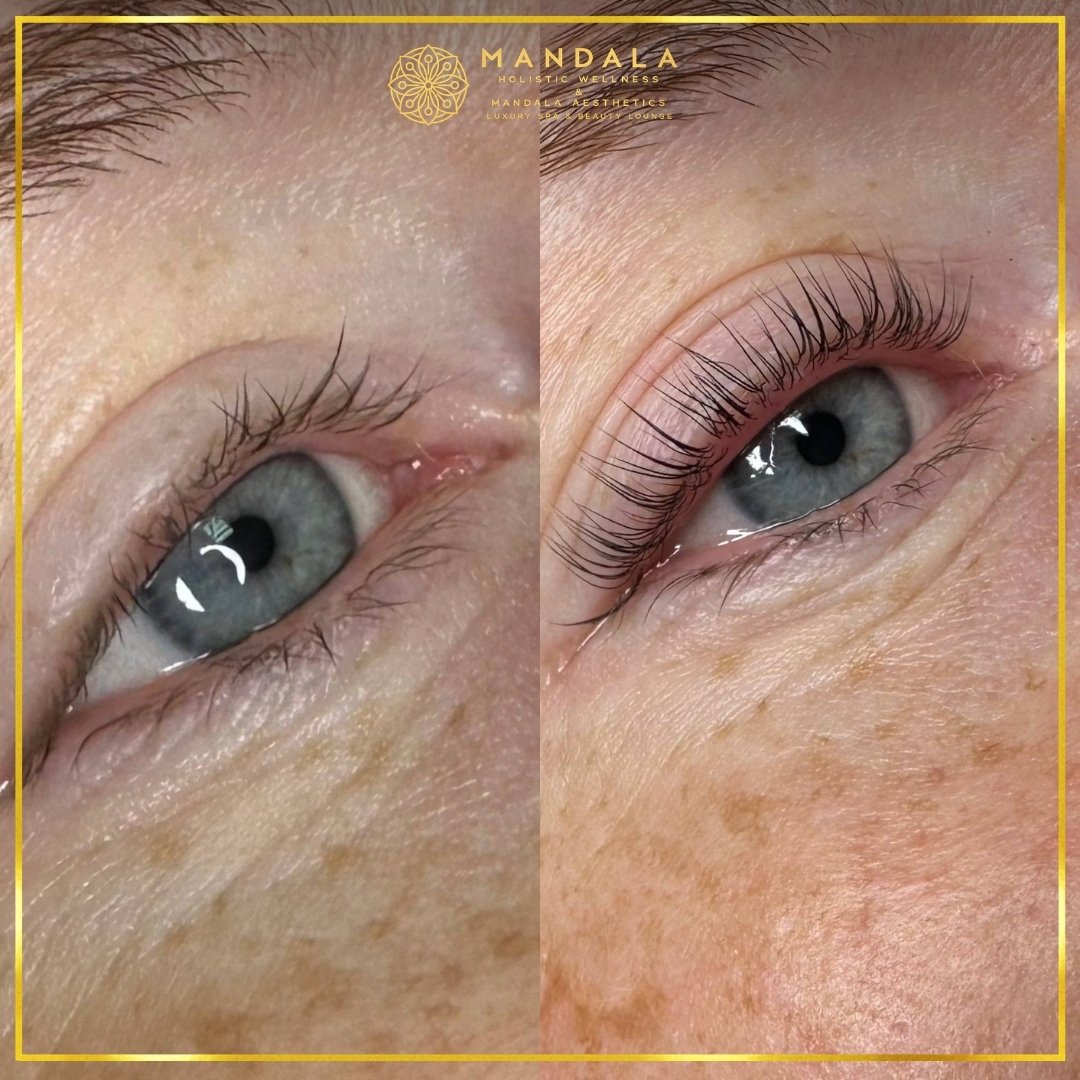 K-Lash Lift and Botox before and after results showing naturally lifted and defined lashes at Mandala Aesthetics in Preston, Melbourne.