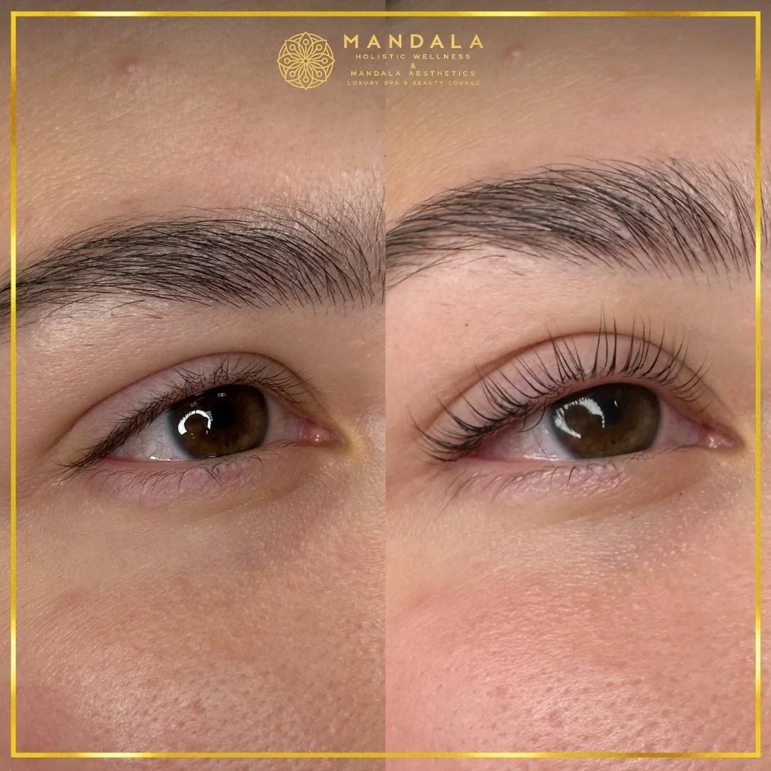 K-Lash Lift and Botox before and after results showing naturally lifted and defined lashes at Mandala Aesthetics in Preston, Melbourne.
