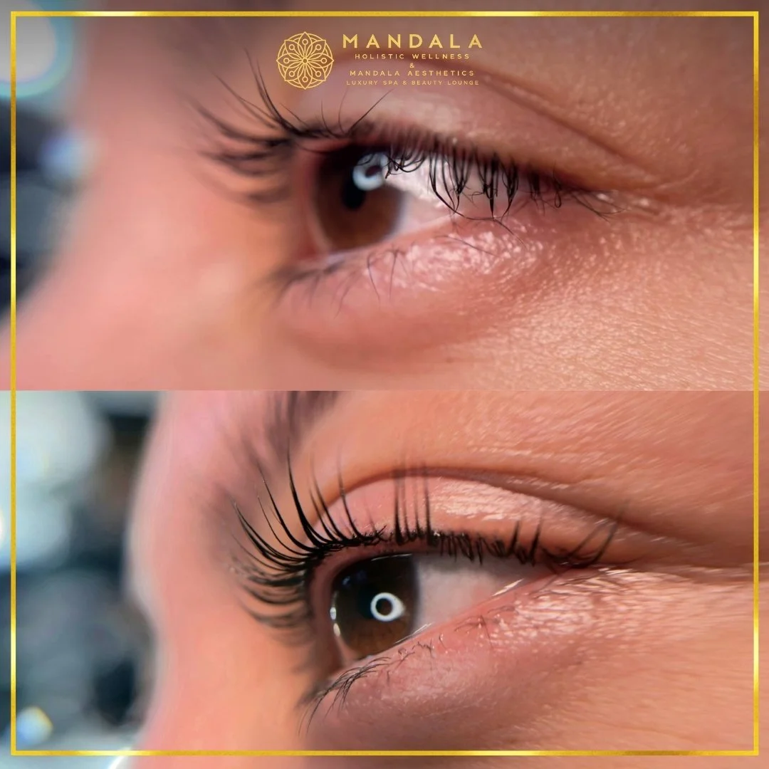 K-Lash Lift and Botox before and after results showing naturally lifted and defined lashes at Mandala Aesthetics in Preston, Melbourne.