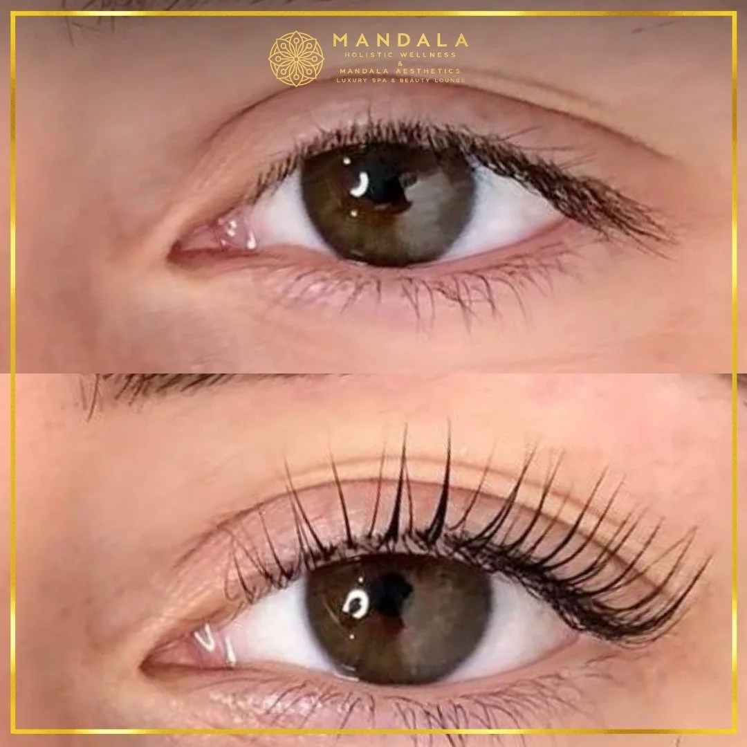 K-Lash Lift and Botox before and after results showing naturally lifted and defined lashes at Mandala Aesthetics in Preston, Melbourne.