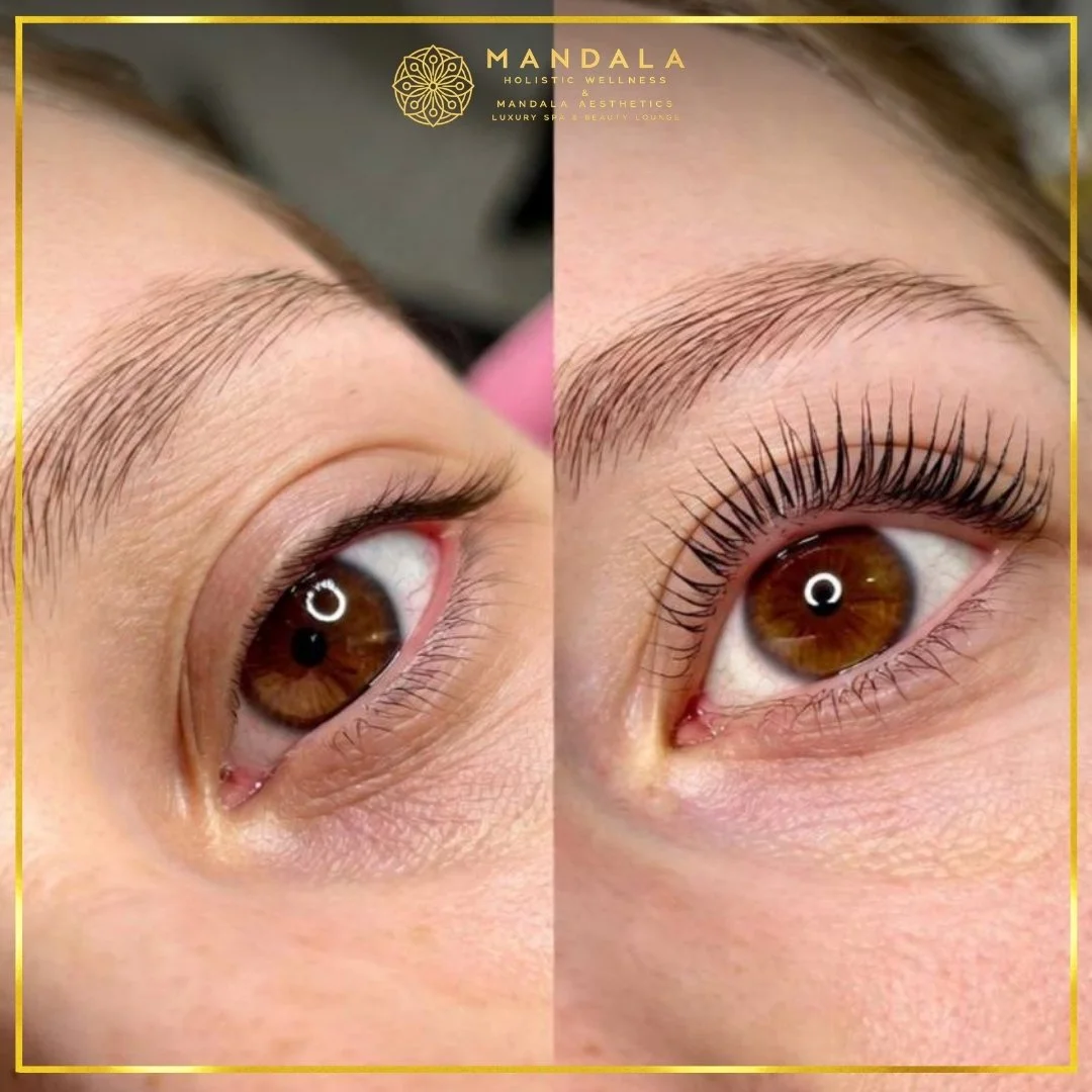 K-Lash Lift and Botox before and after results showing naturally lifted and defined lashes at Mandala Aesthetics in Preston, Melbourne.