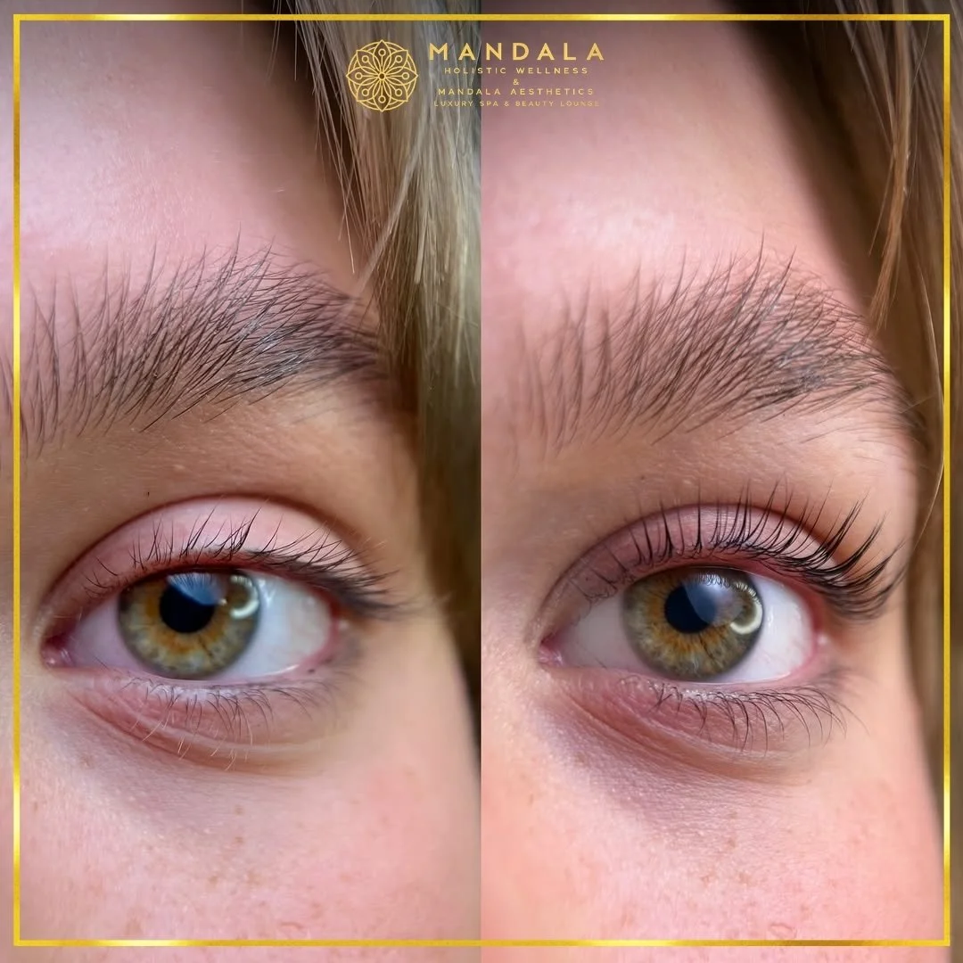 K-Lash Lift and Botox before and after results showing naturally lifted and defined lashes at Mandala Aesthetics in Preston, Melbourne.