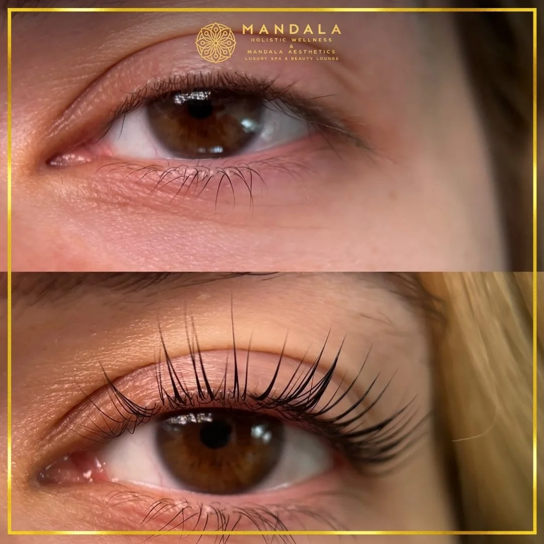 K-Lash Lift and Botox before and after results showing naturally lifted and defined lashes at Mandala Aesthetics in Preston, Melbourne.