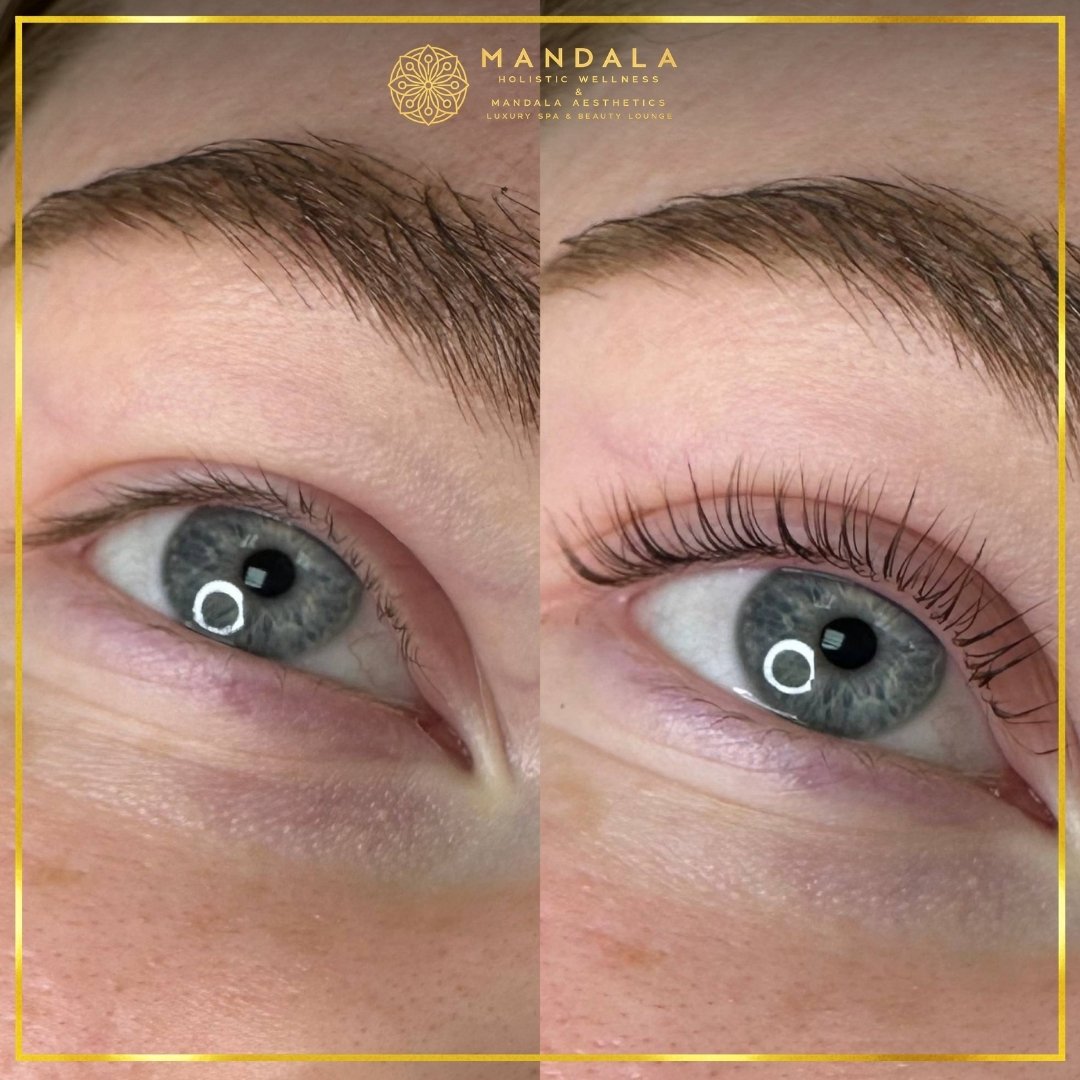 K-Lash Lift and Botox before and after results showing naturally lifted and defined lashes at Mandala Aesthetics in Preston, Melbourne.