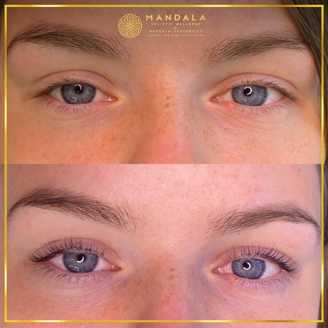 K-Lash Lift and Botox before and after results showing naturally lifted and defined lashes at Mandala Aesthetics in Preston, Melbourne.