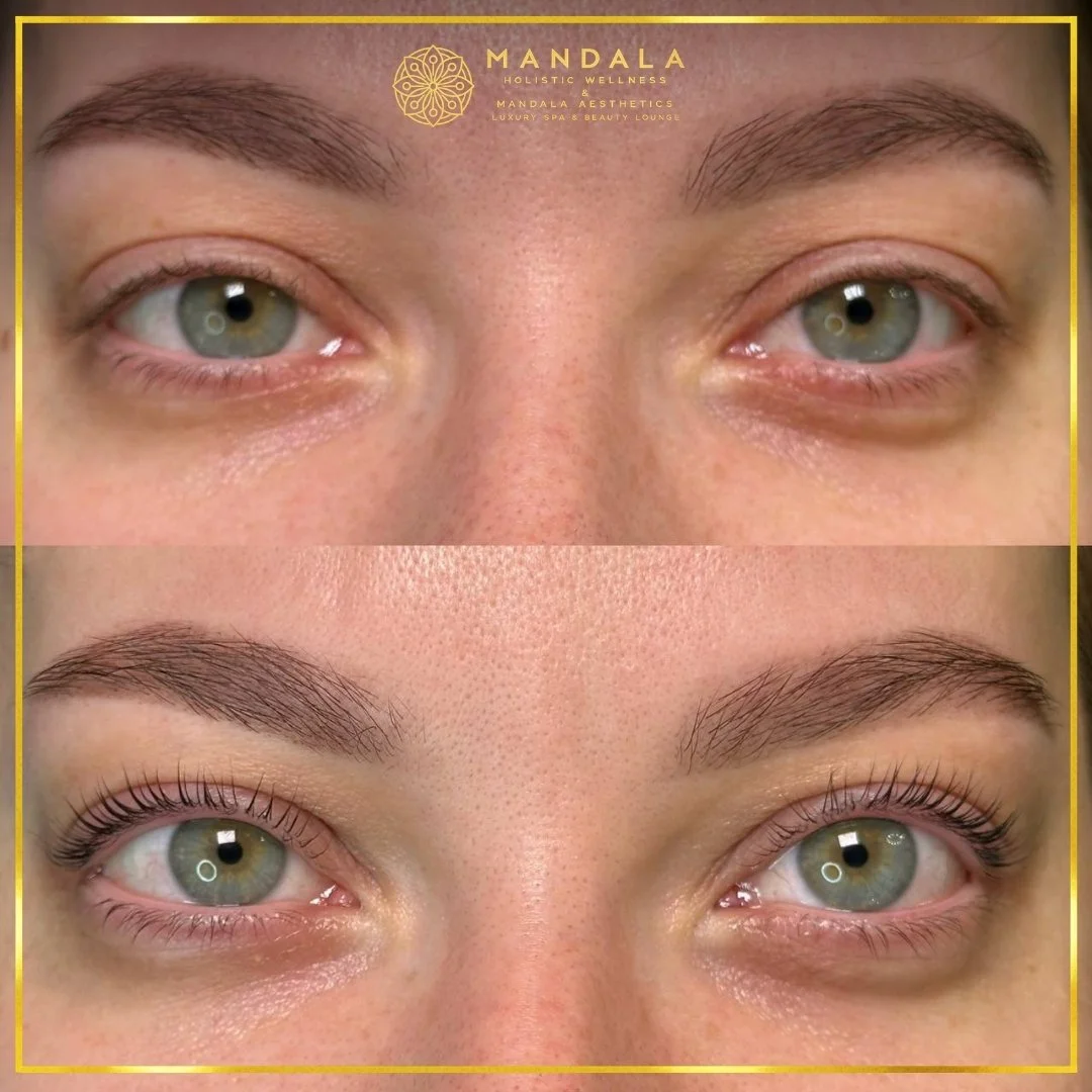 K-Lash Lift and Botox before and after results showing naturally lifted and defined lashes at Mandala Aesthetics in Preston, Melbourne.