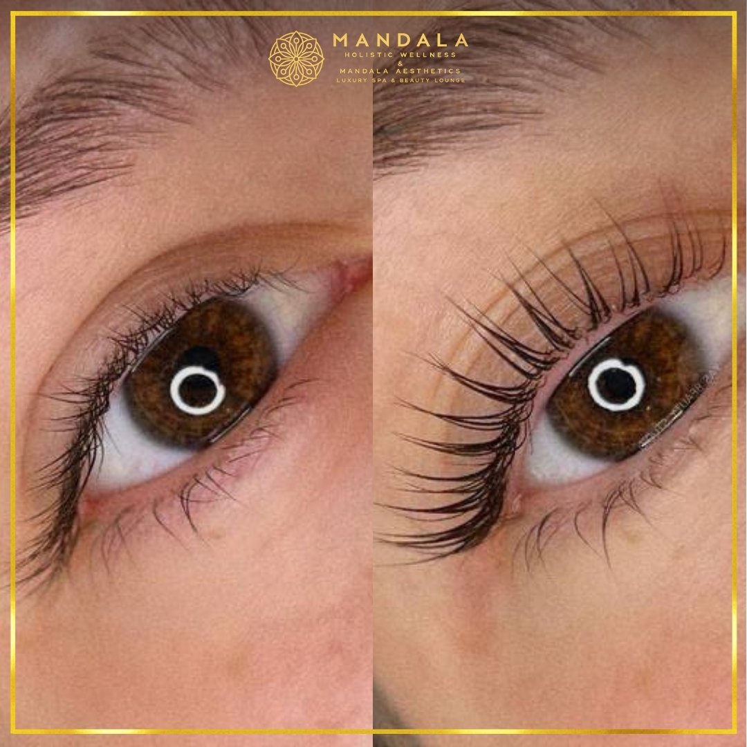 K-Lash Lift and Botox before and after results showing naturally lifted and defined lashes at Mandala Aesthetics in Preston, Melbourne.