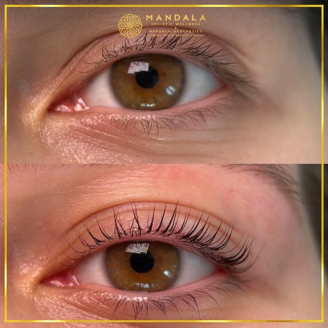 K-Lash Lift and Botox before and after results showing naturally lifted and defined lashes at Mandala Aesthetics in Preston, Melbourne.