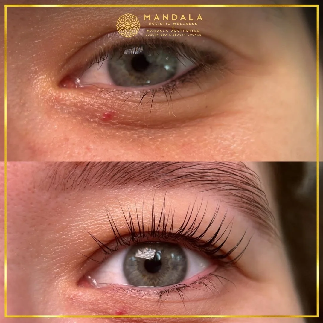 K-Lash Lift and Botox before and after results showing naturally lifted and defined lashes at Mandala Aesthetics in Preston, Melbourne.