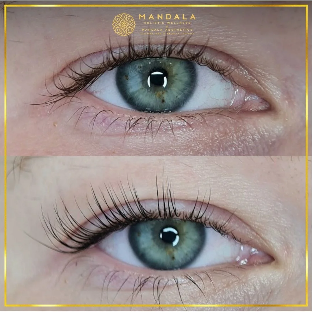 K-Lash Lift and Botox before and after results showing naturally lifted and defined lashes at Mandala Aesthetics in Preston, Melbourne.