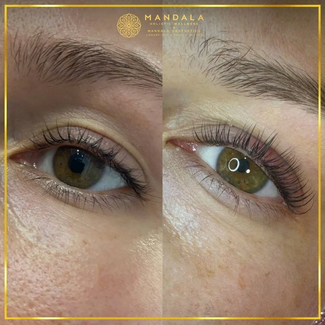 K-Lash Lift and Botox before and after results showing naturally lifted and defined lashes at Mandala Aesthetics in Preston, Melbourne.
