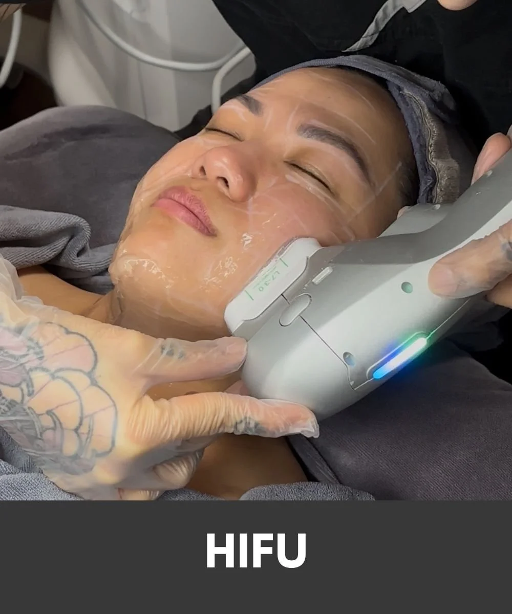 hifu