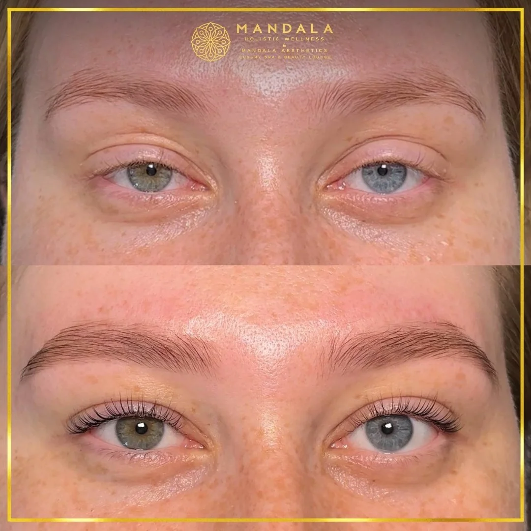 K-Lash Lift and Botox before and after results showing naturally lifted and defined lashes at Mandala Aesthetics in Preston, Melbourne.