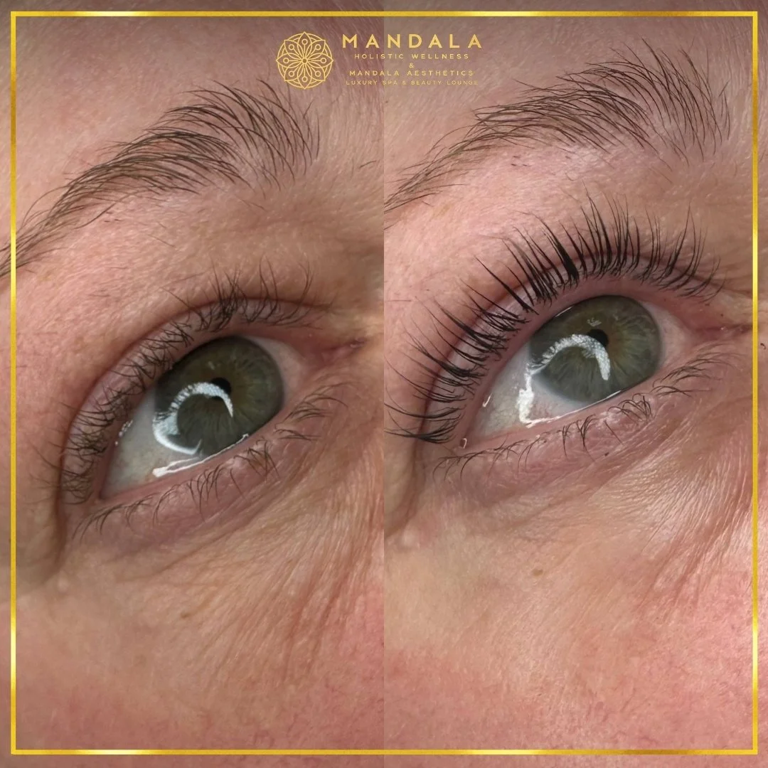 K-Lash Lift and Botox before and after results showing naturally lifted and defined lashes at Mandala Aesthetics in Preston, Melbourne.