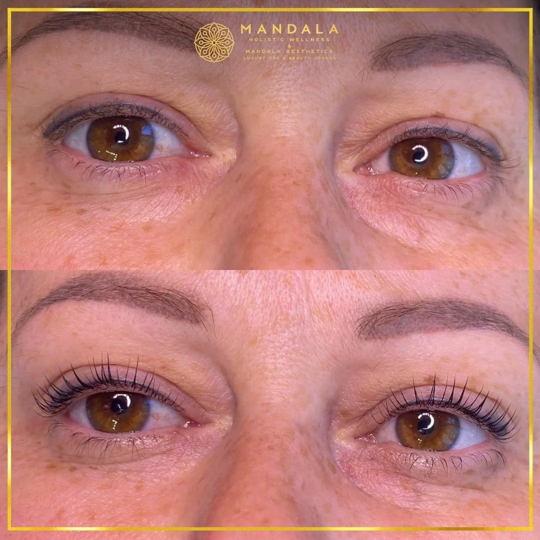 K-Lash Lift and Botox before and after results showing naturally lifted and defined lashes at Mandala Aesthetics in Preston, Melbourne.