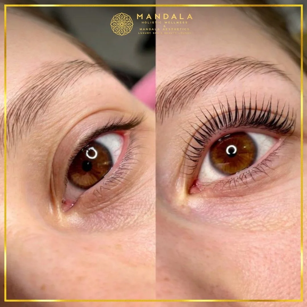 K-Lash Lift and Botox before and after results showing naturally lifted and defined lashes at Mandala Aesthetics in Preston, Melbourne.