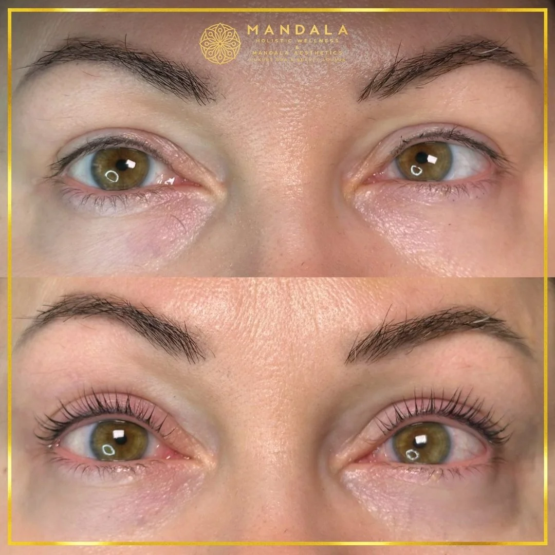 K-Lash Lift and Botox before and after results showing naturally lifted and defined lashes at Mandala Aesthetics in Preston, Melbourne.