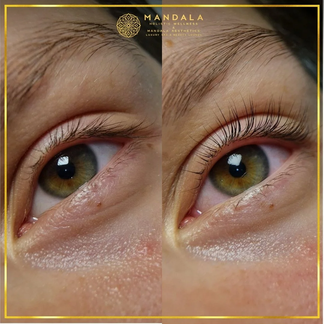 K-Lash Lift and Botox before and after results showing naturally lifted and defined lashes at Mandala Aesthetics in Preston, Melbourne.