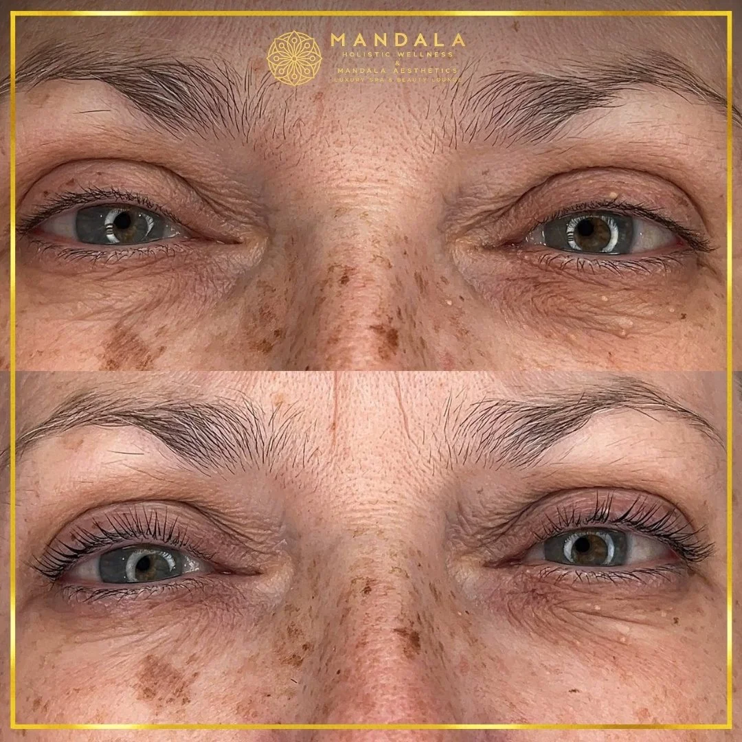 K-Lash Lift and Botox before and after results showing naturally lifted and defined lashes at Mandala Aesthetics in Preston, Melbourne.