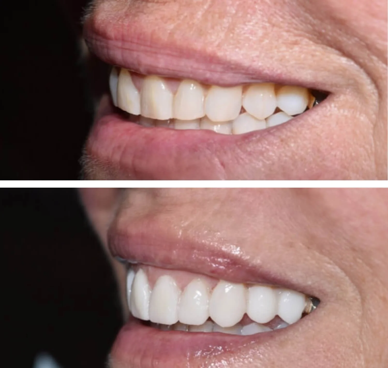 smile-gallery-1.jpg