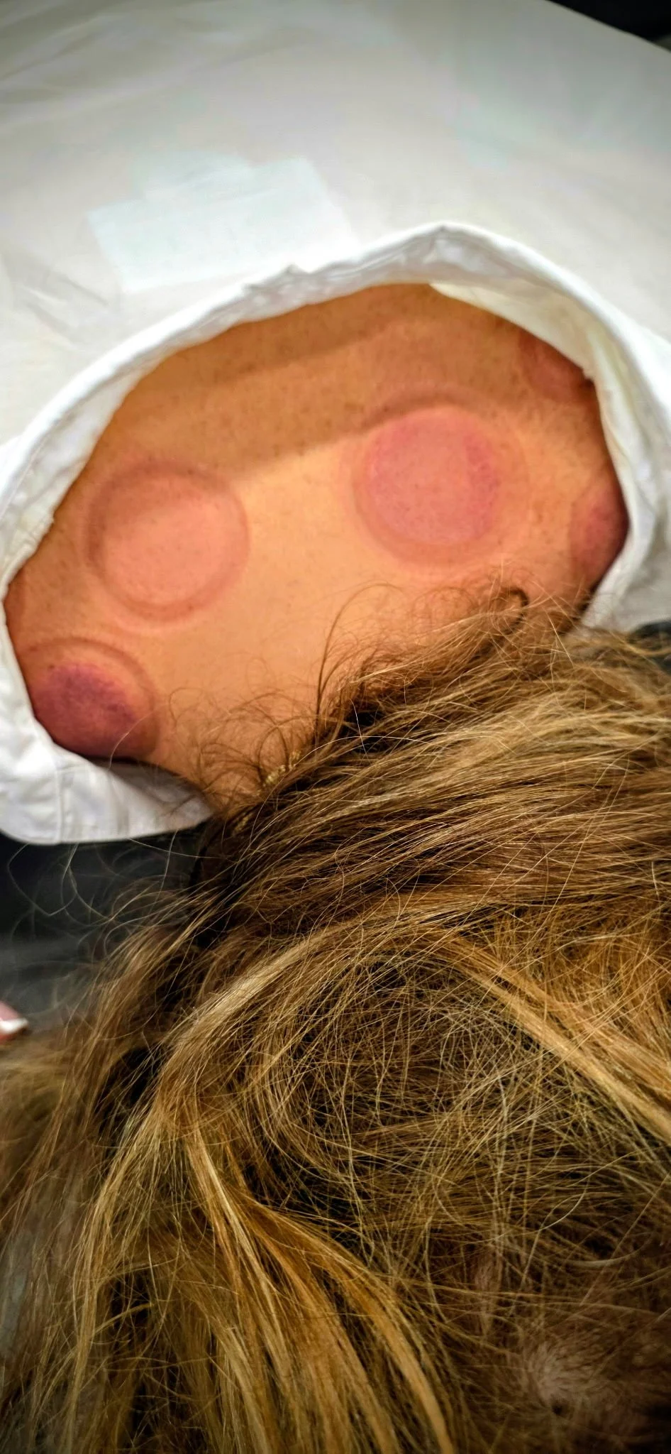 Cupping w: Tim Rylander.JPG