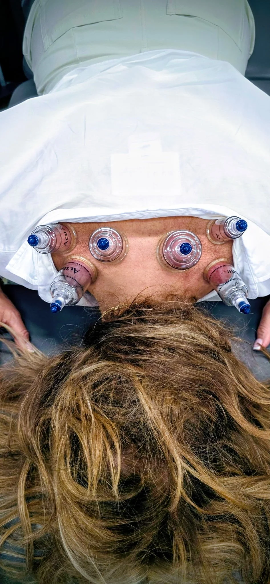 Cupping w: Tim Rylander4.JPG