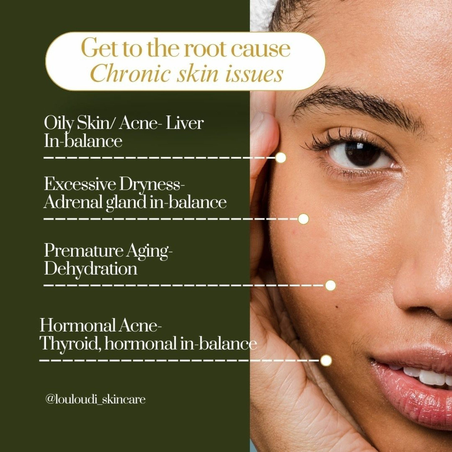 Chronic skin conditions are often connected to a deeper root cause. To truly heal your skin, you must look within and address the underlying issues. At Louloudi Skincare, we provide insights and solutions that go beyond surface-level treatments. Visi