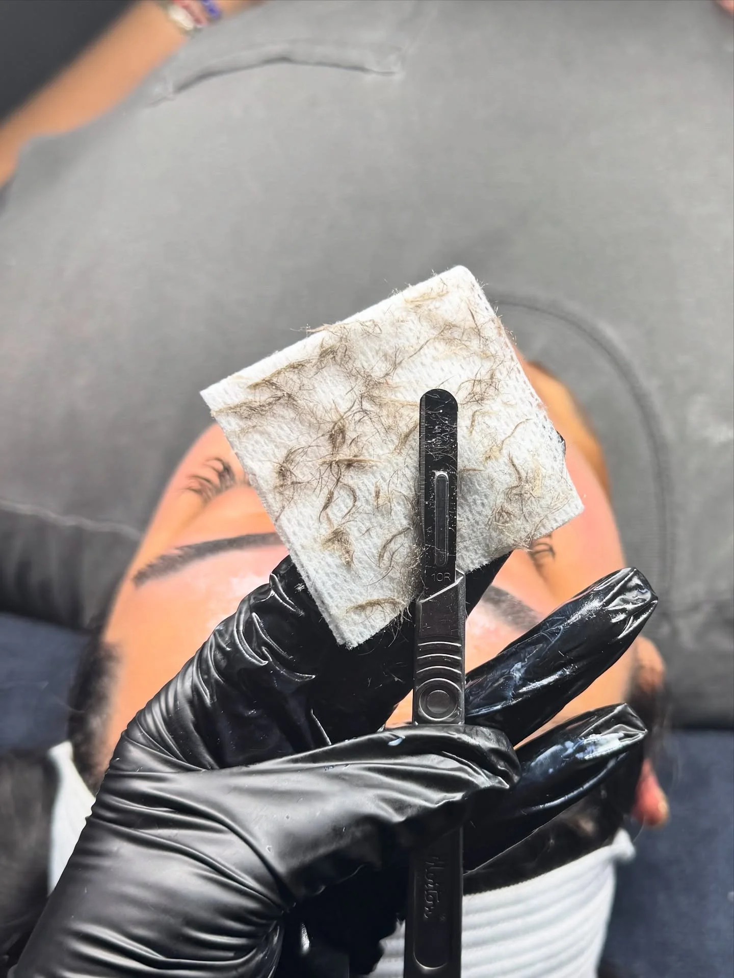 @houseofestheticsmn and @dermaplanepro go together real bad🔪