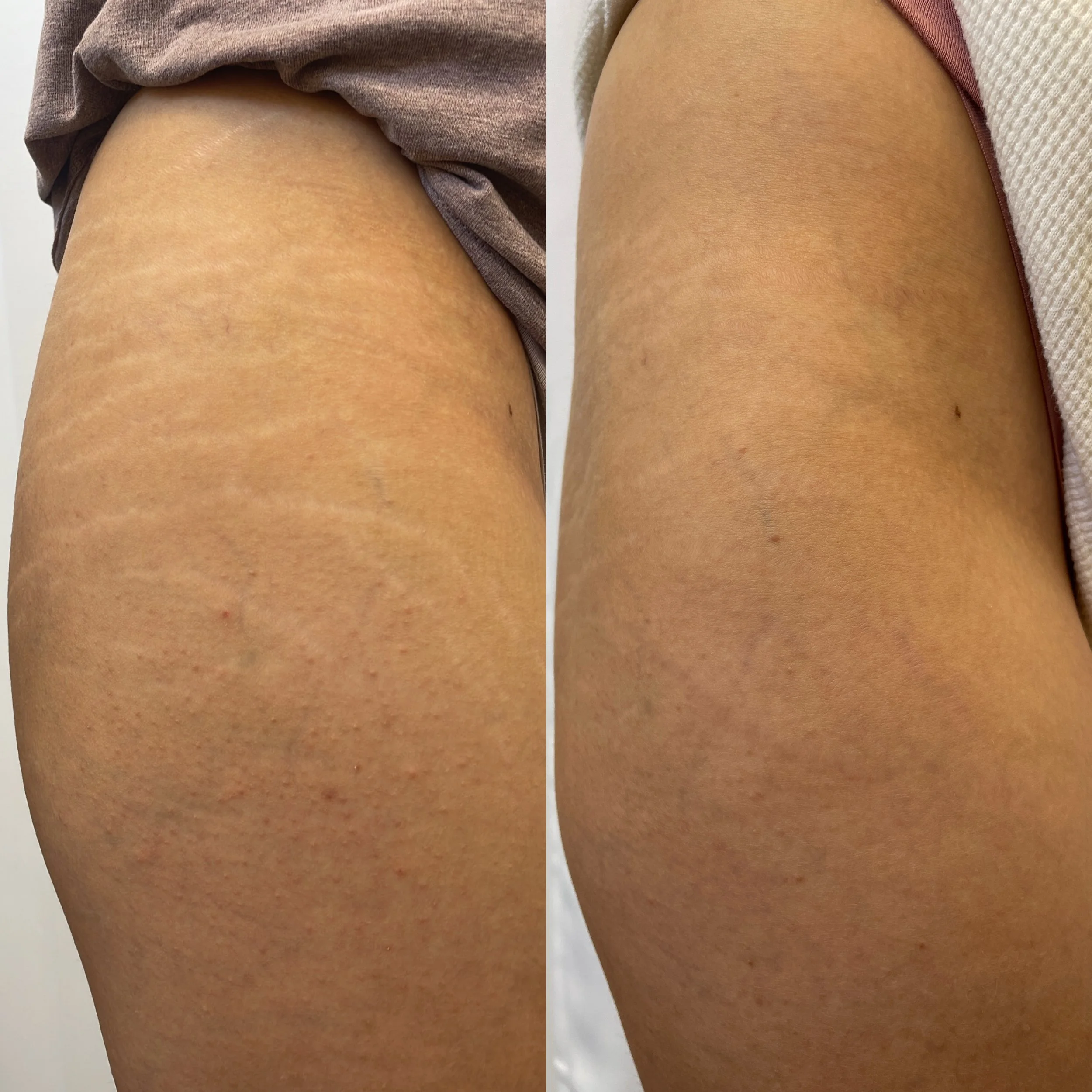 photo-output (5).JPG